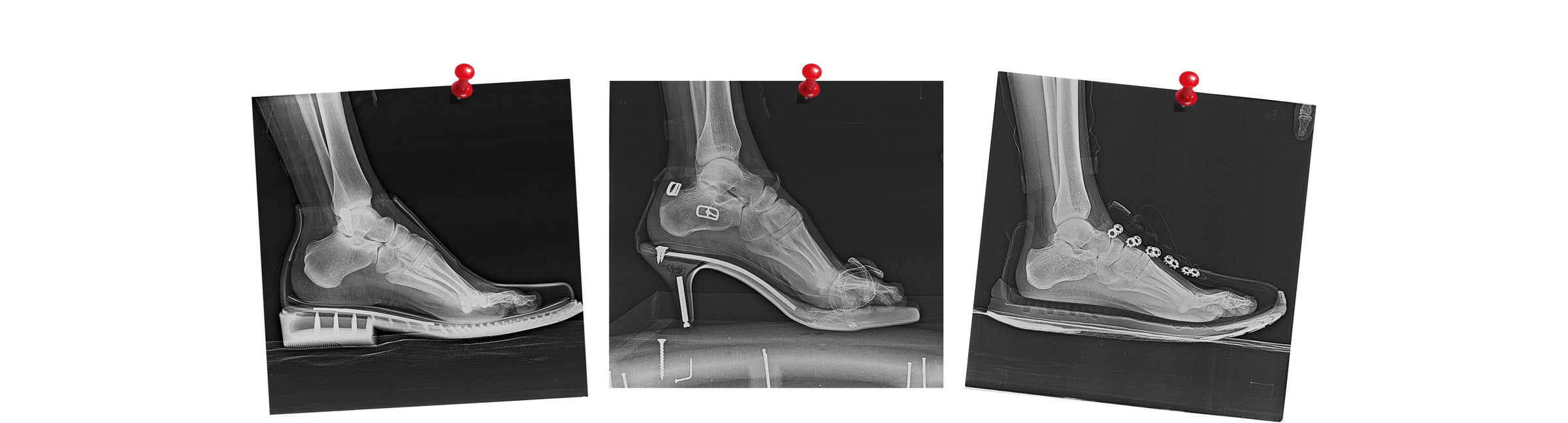  Vaistoa Barefoot Shoe